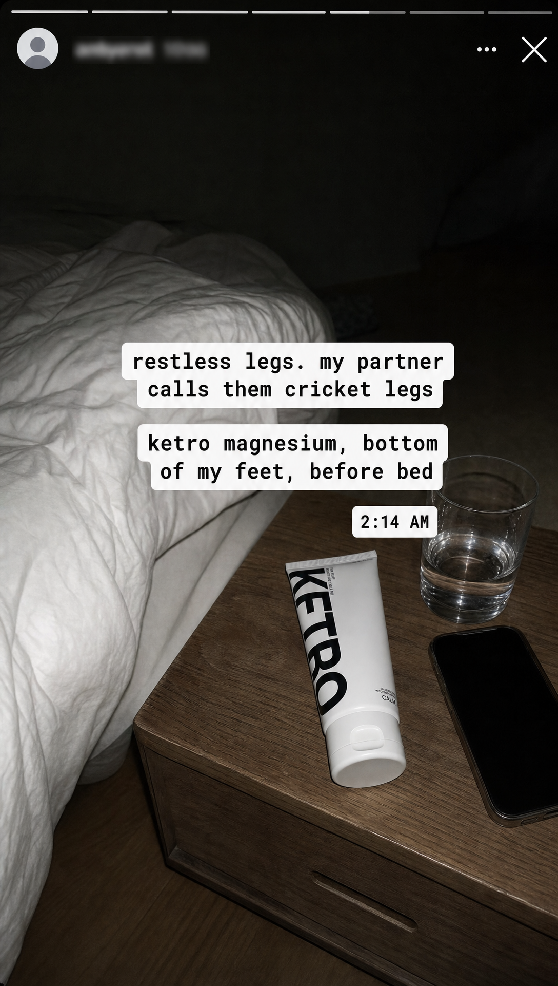 02. UGC IG Story: restless legs at night